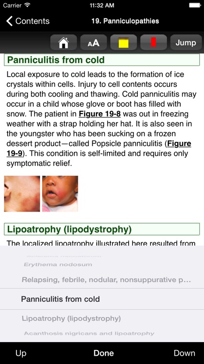 Atlas of Pediatric Dermatology