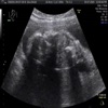 Baby UltraSound