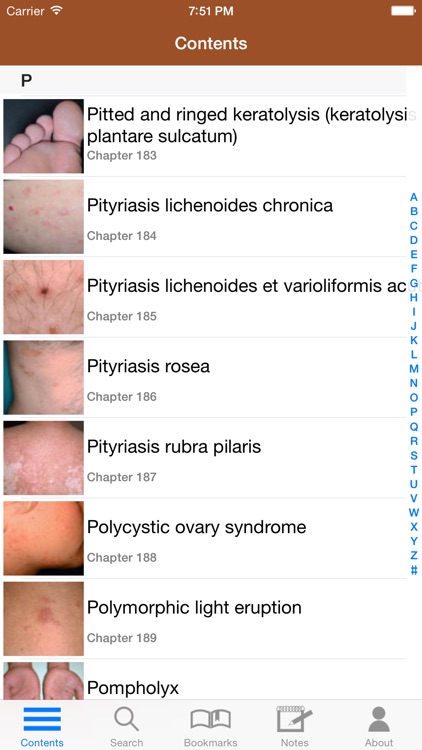 Treatment of Skin Disease, 4/E