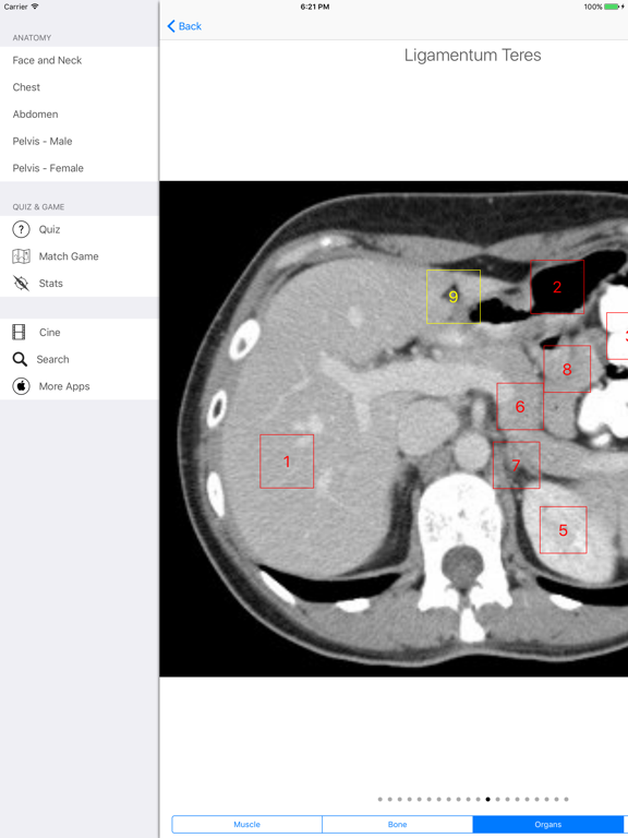 Screenshot #4 pour iAnatomy
