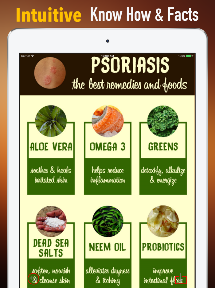 牛皮癣食谱知识百科-快速自学参考指南和教程视频