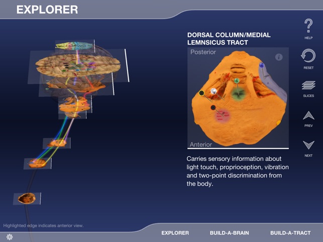 Build-A-Brain Explorer(圖2)-速報App