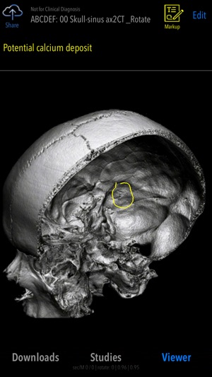 MedVizi Medical Imaging(圖2)-速報App