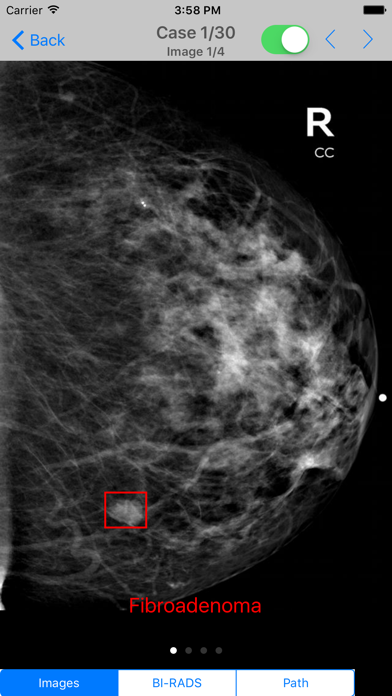 Mammogram Atlasのおすすめ画像4
