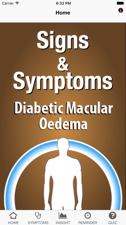 Signs & Symptoms Diabetic Malucar Oedema