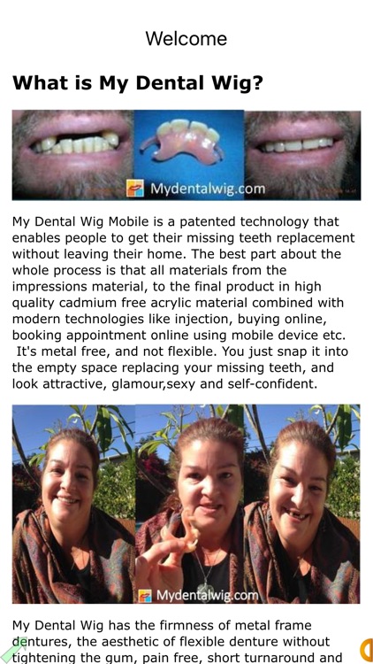 My Dental Wig Mobile Missing Teeth Services by EPage Inc