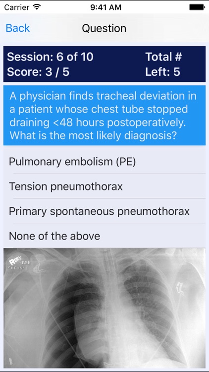 Medical Surgical Nurse Review