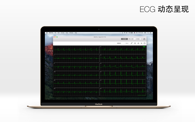 ECG Pro - 12導聯動態心電圖(圖1)-速報App