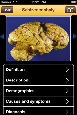 Dictionary of Neurological Disorders for iPhone screenshot 2