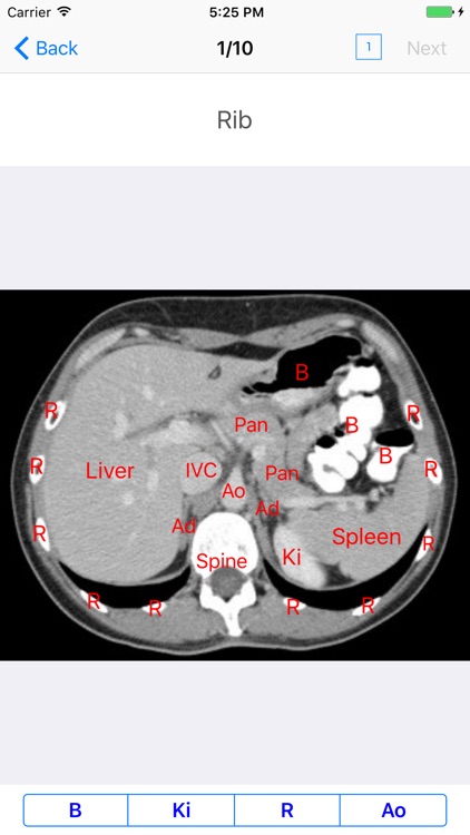 iAnatomy for Patients