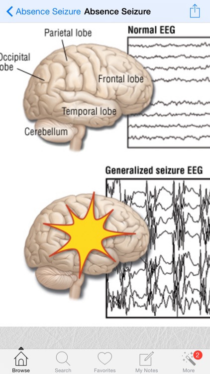 1000 Neurology Medical Dictionary