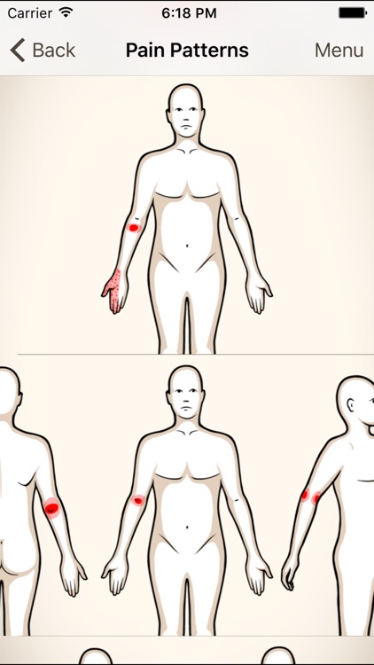 Clinical Pattern Recognition: Elbow Pain