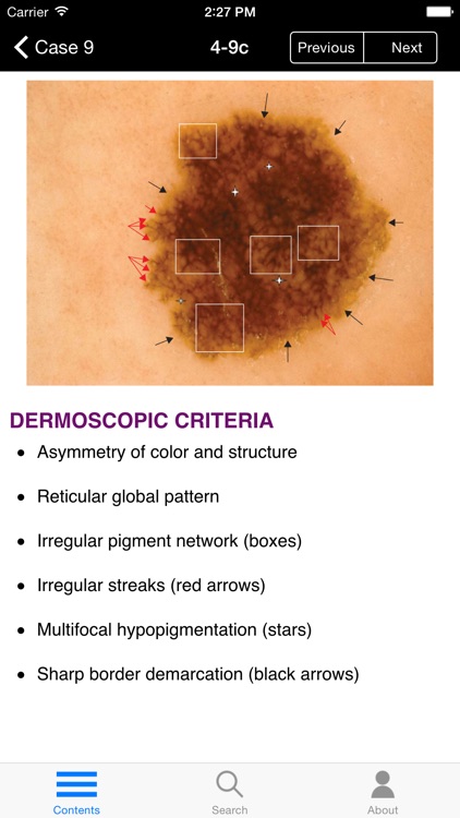 Dermoscopy: An Illustrated Self-Assessment Guide screenshot-3