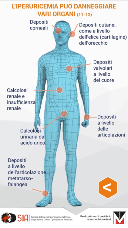 SEI IPERTESO? CONTROLLA ANCHE L'URICEMIA