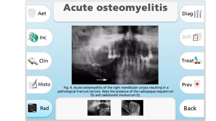 Maxillofacial Pathology screenshot-3