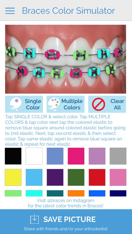 @braces screenshot-4