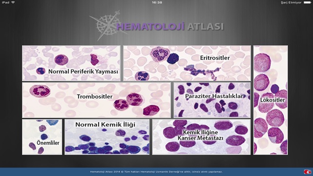 Hematoloji Atlası(圖1)-速報App