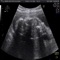 If you are looking for a great wow effect baby ultrasound is for you
