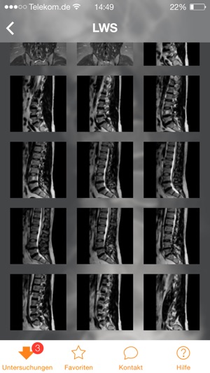 DIE RADIOLOGIE(圖4)-速報App