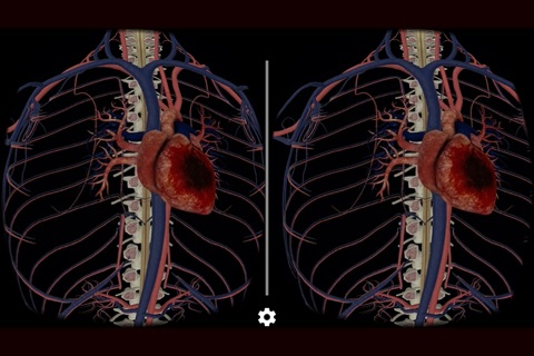 Cholesterol VR screenshot 2