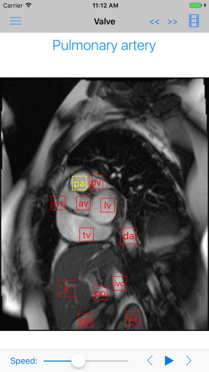 iAnatomy-Cardiac