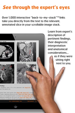 Radiology - Abdomen Dynamic screenshot 4