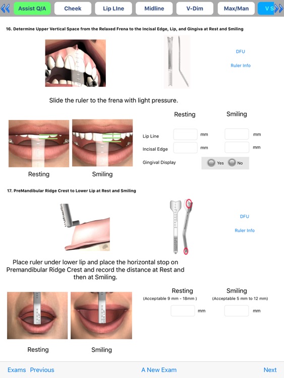 Facial Analysis