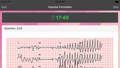 How to cancel & delete ECG Master - Quiz, Exam, Explanation, Statistic from iphone & ipad 2