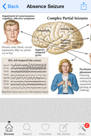 1000 Neurology Medical Dictionary - náhled