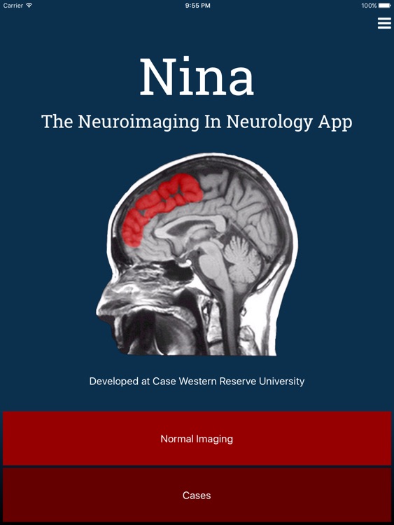 Nina: Neuroimaging In Neurology App (Full Version)
