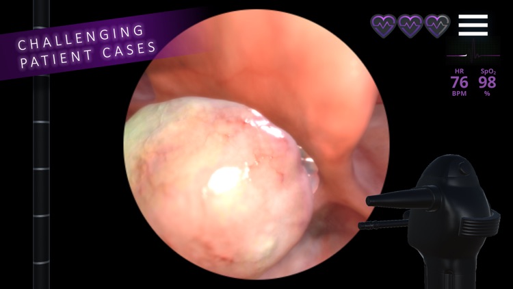 Airway EX Virtual Surgery Simulator