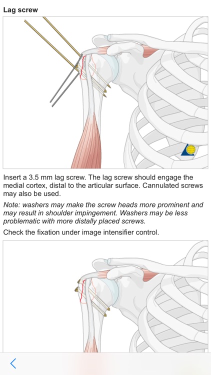 AO Surgery Reference screenshot-4