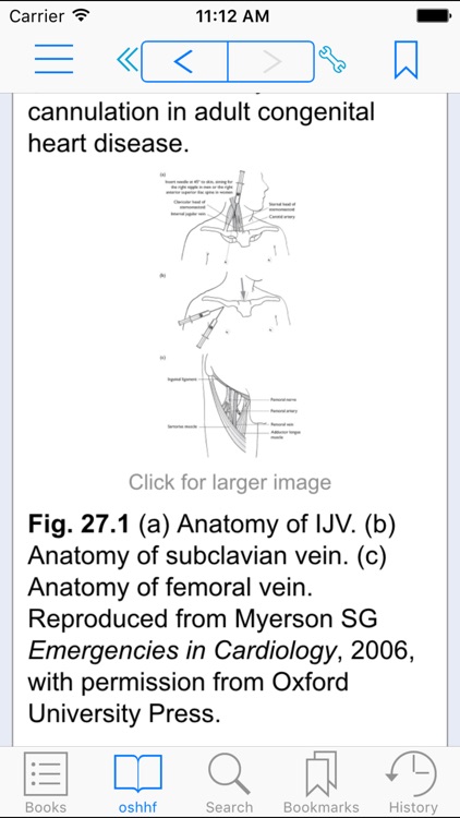 Heart Failure, Second Edition