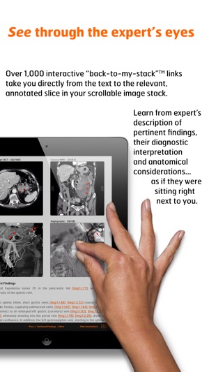 Dynamic Approach to Abdominal Radiology(圖4)-速報App