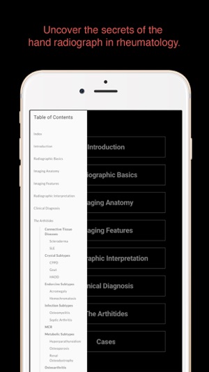 ESIMR: Uncovering The Hand Radiograph(圖3)-速報App