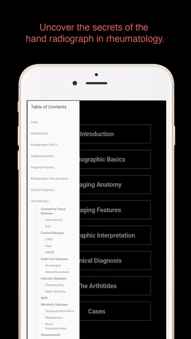 How to cancel & delete ESIMR: Uncovering The Hand Radiograph from iphone & ipad 3