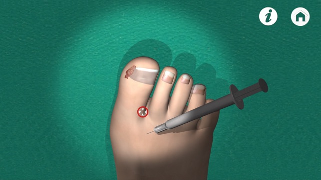 Podiatry 3D(圖3)-速報App