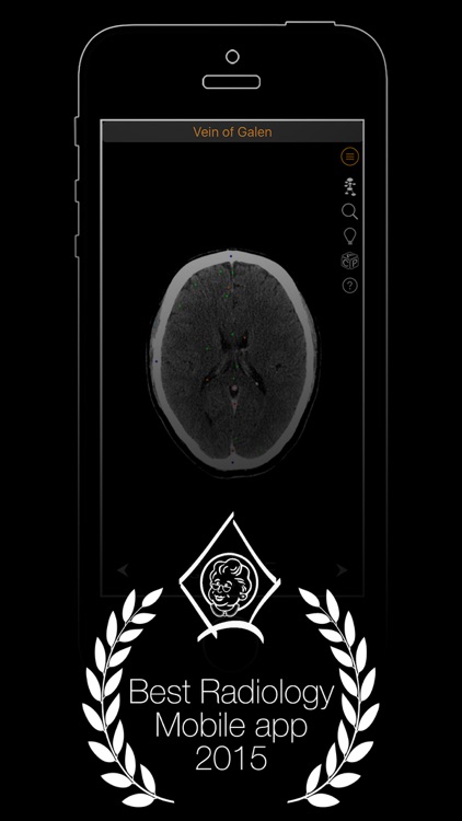 CT Anatomy screenshot-0