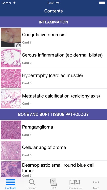 Anatomic Pathology Flashcards