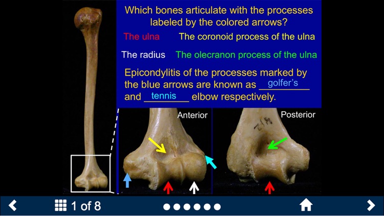 MSK Anatomy Lite - SecondLook