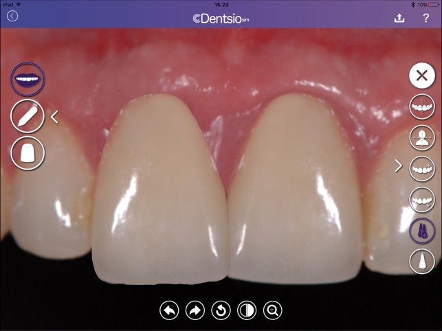 DentsioSim(圖2)-速報App