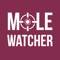 MoleWatcher is a tool that helps you track changes in your moles