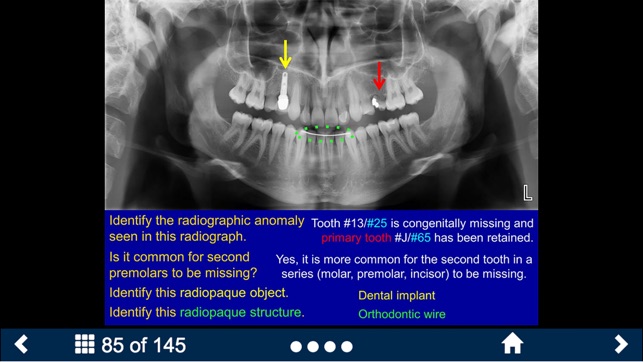 Oral Radiology - SecondLook(圖2)-速報App