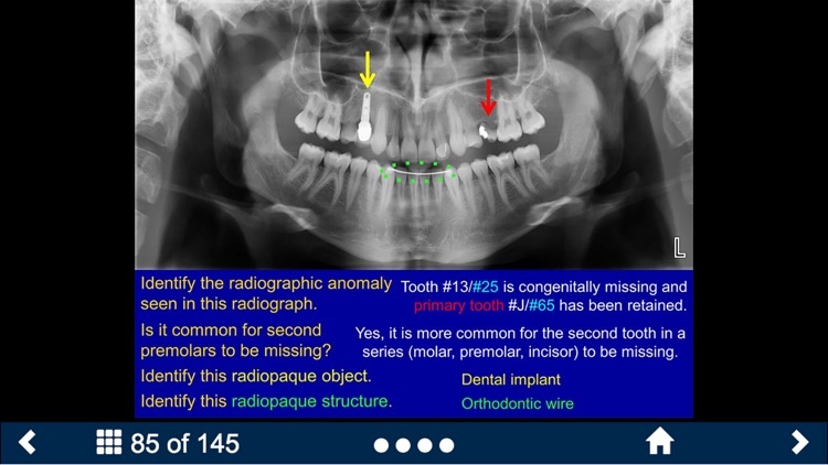 Oral Radiology - SecondLook