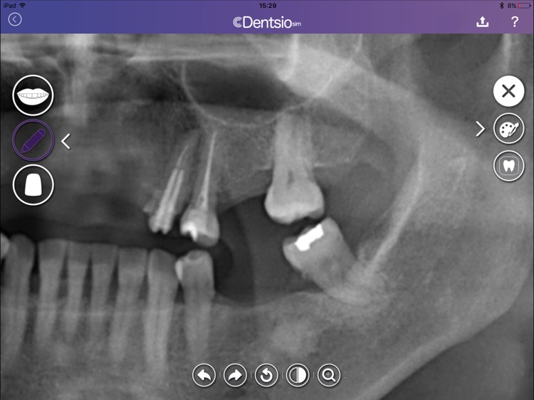 DentsioSim screenshot-4