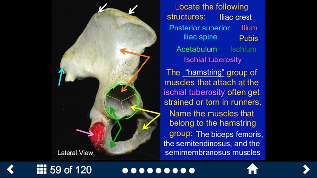 MSK Anatomy - SecondLook(圖5)-速報App