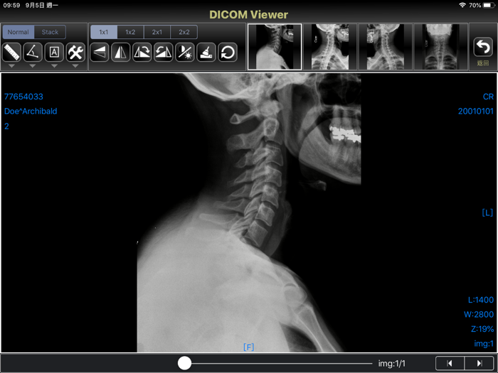 DICOM Viewer