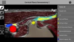 How to cancel & delete anso anaesthesia sonoanatomy 2