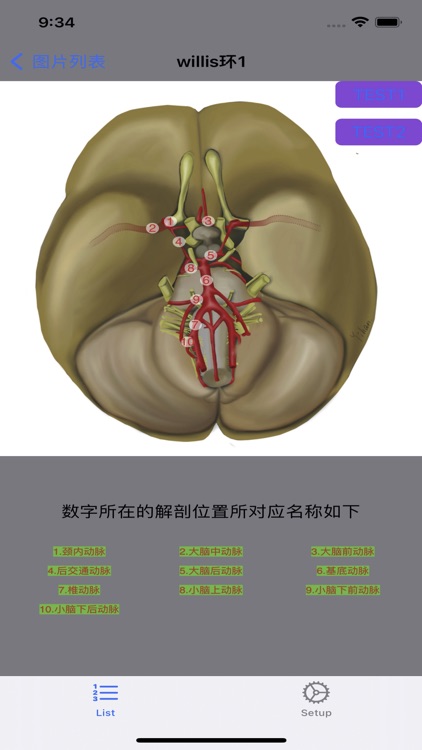 脑血管学习