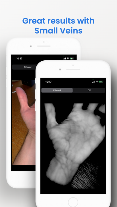 VeinSeek Pro VeinSeek Pro